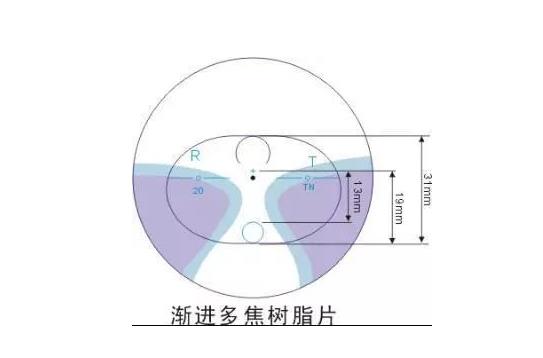美麗島多焦鏡適合的人群，需要注意的事項
